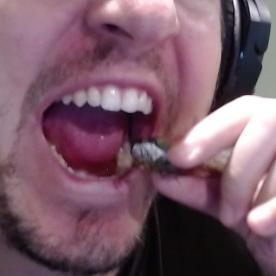 burp010